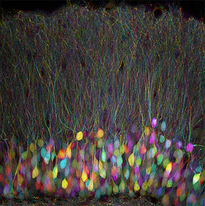 Photo of Neurons